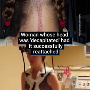 An Illinois woman whose head was internally decapitated