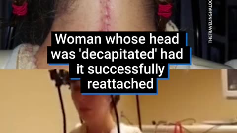 An Illinois woman whose head was internally decapitated