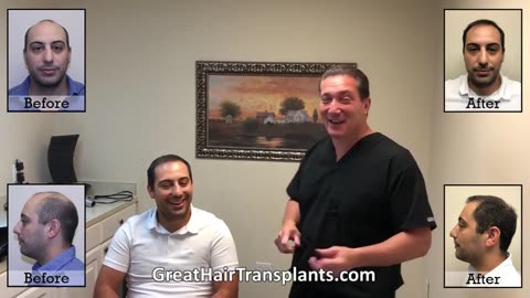 Dr. Brett Bolton – MaxHarvest™ Hair Transplant on Class 6 Hair Loss (Patient Jose)