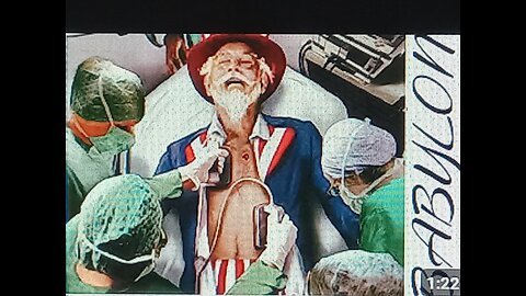 ESAU YOU'VE BEEN MADE BARE, BY THE PROPHETS FIRST...-GMS RAWCHAA GABAR 144