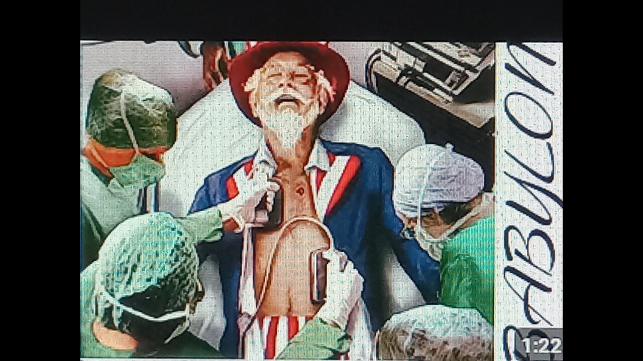 ESAU YOU'VE BEEN MADE BARE, BY THE PROPHETS FIRST...-GMS RAWCHAA GABAR 144