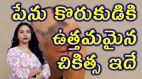 పేను కొరుకుడుకి ఉత్తమమైన చికిత్స ఇదే?Best Homeopathy Treatment for Alopecia Areata or Spot Baldness