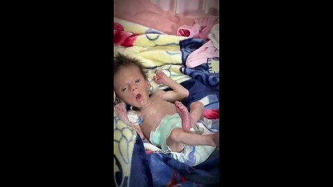 Four-Month-Old Palestinian Infant Dies from Malnutrition Amid Gaza Siege
