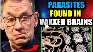 Scientists Discover| Parasitic🧠🪱🤯 Entities in Brains| of Jabbed