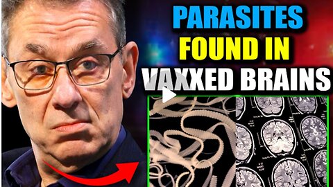 Scientists Discover| Parasitic🧠🪱🤯 Entities in Brains| of Jabbed