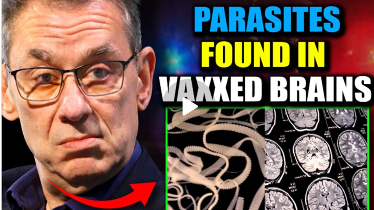 Scientists Discover| Parasitic🧠🪱🤯 Entities in Brains| of Jabbed