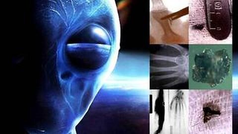 "Unraveling the Mysteries: Alien Implants, Mark of The Beast & Anti-Christ Corporations"