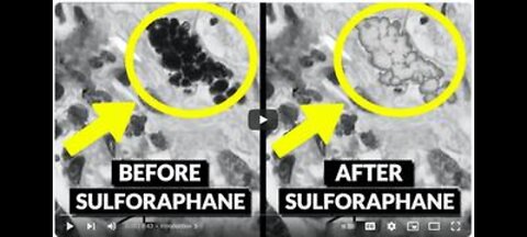 DETOXING MICROPLASTICS