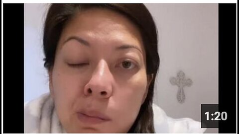 "Radio Host Carol Smith Affected by Bell's Palsy"
