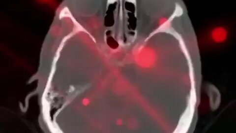 MIND CONTROLLED MANCHURIAN CANDIDATES