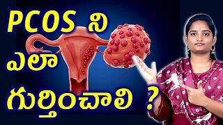 PCOS ఎలా గుర్తించాలి? | Polycystic Ovary Syndrome Signs, Causes & Complete Homeopathy Medicine Cure
