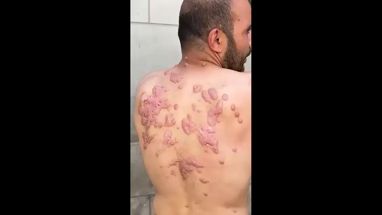 PALESTINIAN PRISONER RELEASED AFTERMATH