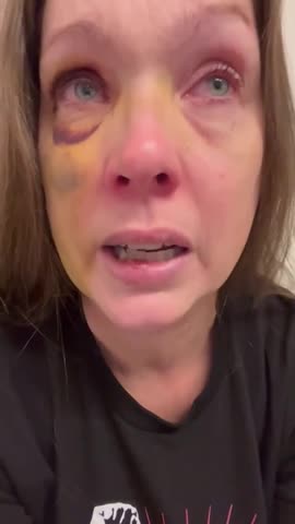 WHITE MOM Who Was Brutally Beaten in Cinci