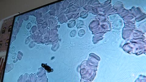 S.C. First Disease Test July 22nd 2025