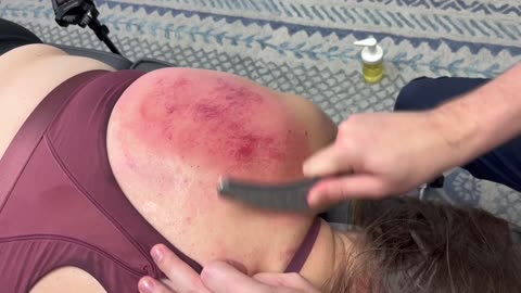 *ASMR CLIP* FAST SHOULDER RECOVERY