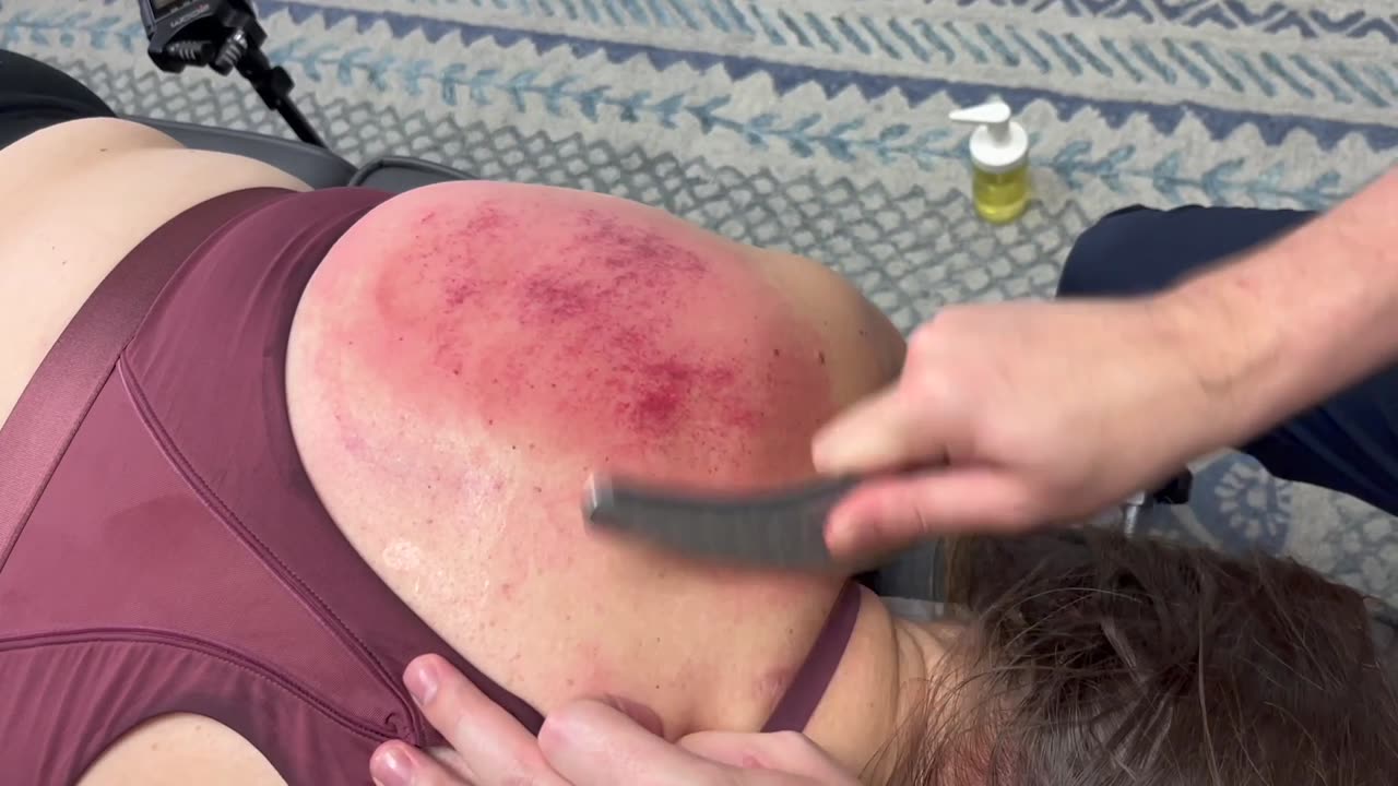 *ASMR CLIP* FAST SHOULDER RECOVERY