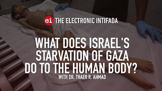 What does Israel’s starvation of Gaza do to the human body? With Dr. Thaer Ahmad