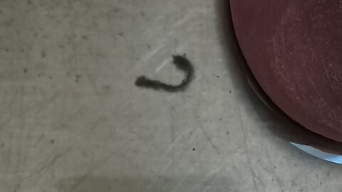 MUST SEE & SHARE: Hookworm Parasite-Watch till the End