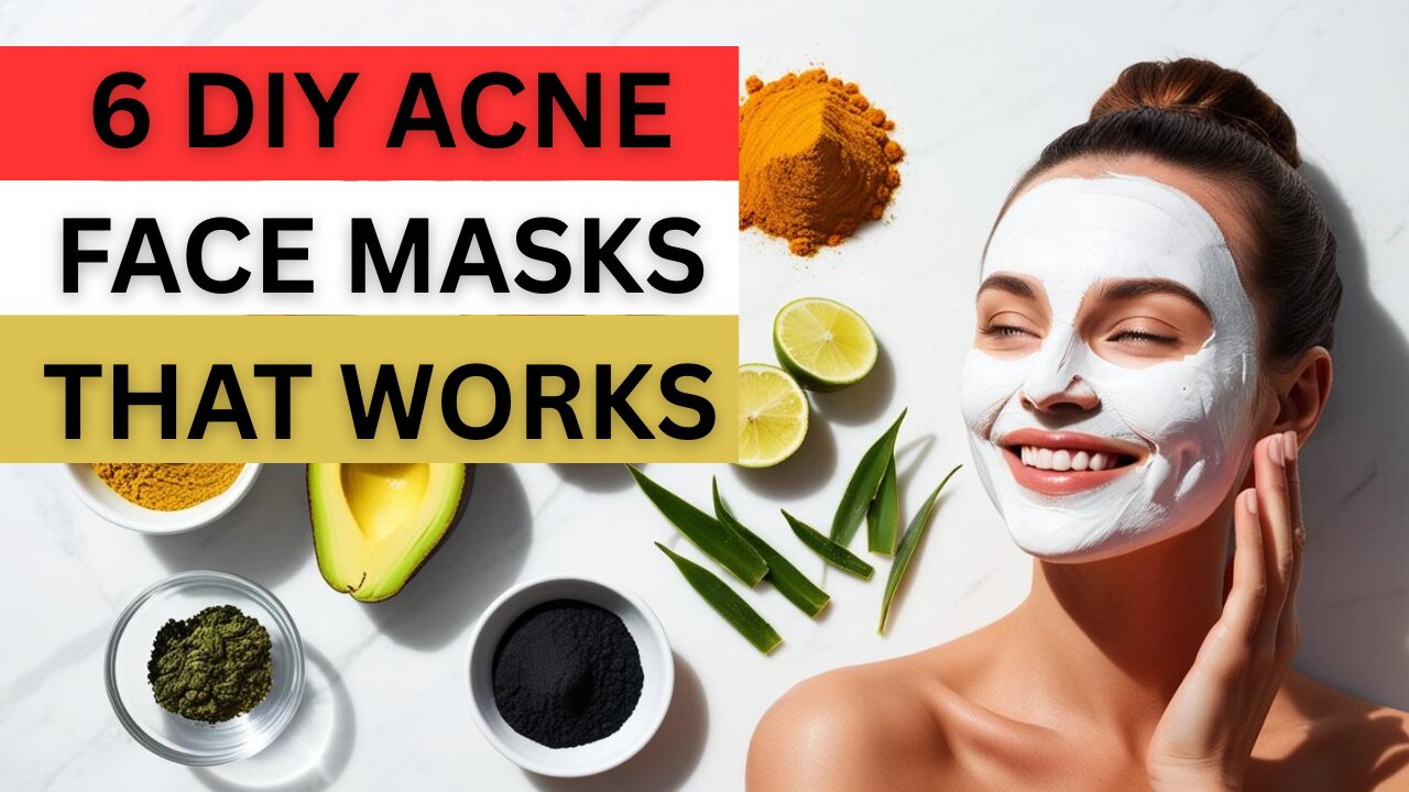 6 Homemade DIY Face Masks For Acne!