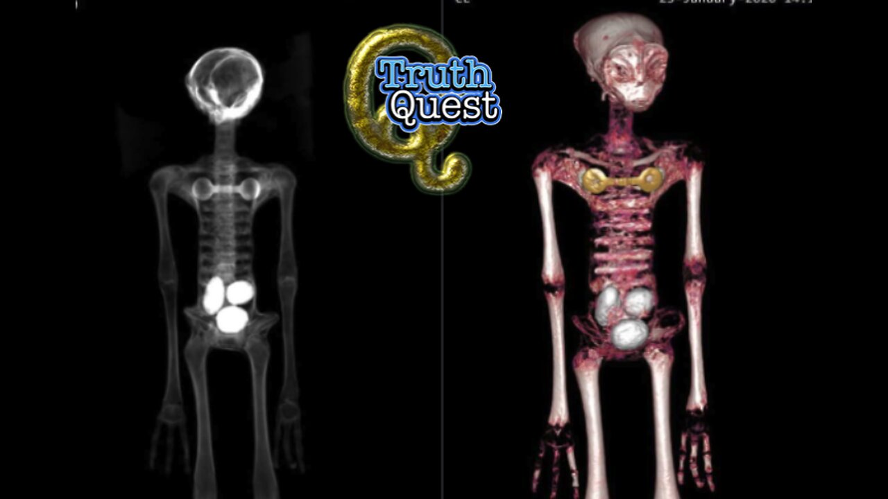 Truth Quest with Aaron Moriarity #616 "FULL DISCLOSURE"