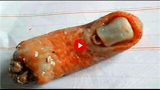 Human DNA, A finger, a tooth, they are feeding us Human flesh every chance they get!