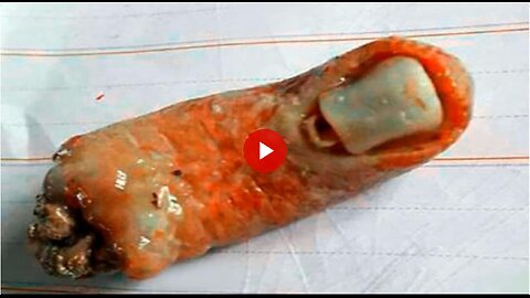 Human DNA, A finger, a tooth, they are feeding us Human flesh every chance they get!