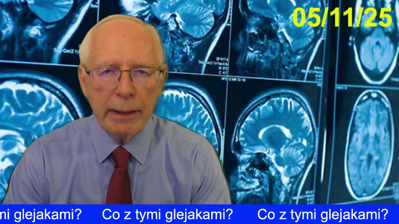 Co z tymi glejakami?