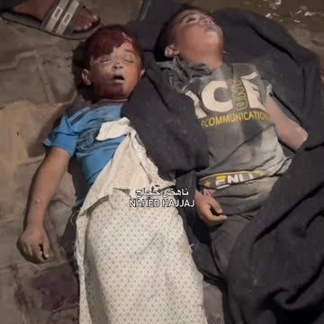 Six-year-old twins Amir and Zein were born in the same womb and died together