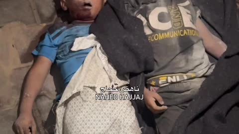 Six-year-old twins Amir and Zein were born in the same womb and died together