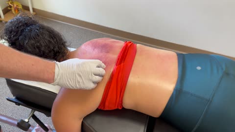 ALL THIS WAS INSIDE HER BACK😱