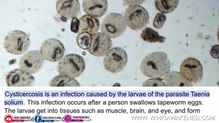 Every Disease know to man comes from or connected to Parasites/ aka demons.