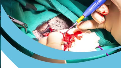 Expert Care for Giant Cell Tumors| Dr. Mohamed Mashhour- Ortho| Giant Cell Tumors Treatment
