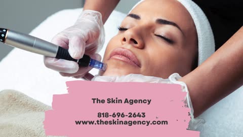 Microneedling Glendale