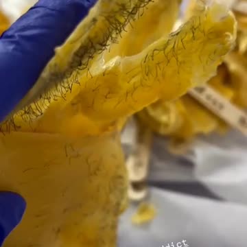 Brazilian Wax Using Sexy Smooth Golden Allure Hard Wax in New York | Full Strip Results Shown!