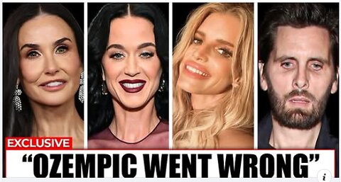 SHOCKING Celebrity OZEMPIC Transformations 2025 That Went Too Far - Union Stories