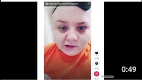 "Uncovered: New Instance of COVID-19 Vaccine Leading to Bell's Palsy, Facial Paralysis"
