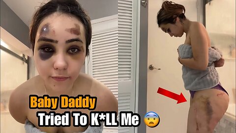 "He Ran Me Over Beat Me Up" Bruised Single Mother Says Men Should Pay All Her Bills