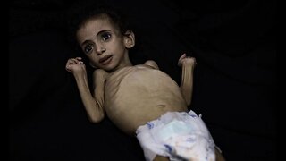 Gaza: 4-Year-Old Palestinian Girl Dies from Malnutrition as Israeli Blockade Continues