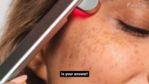 Shine Fixx - Red light therapy wand-🔥 Save 15% now – click the link below to grab your offer!