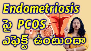 Endometrium పై PCOS ఎఫెక్ట్ ఉంటుందా? Does PCOS Effect Endometrial Hyperplasia Best Treatment Cure