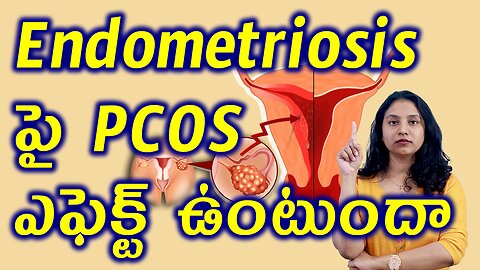 Endometrium పై PCOS ఎఫెక్ట్ ఉంటుందా? Does PCOS Effect Endometrial Hyperplasia Best Treatment Cure