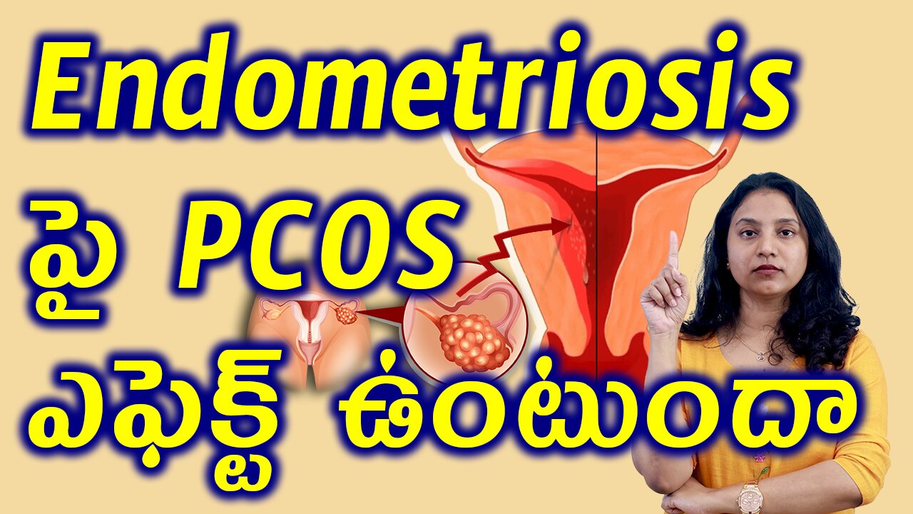 Endometrium పై PCOS ఎఫెక్ట్ ఉంటుందా? Does PCOS Effect Endometrial Hyperplasia Best Treatment Cure