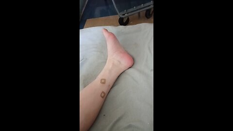 just tons of holes in my skin