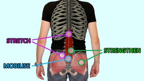 6 Essential Exercises For Back Pain Relief & Prevention