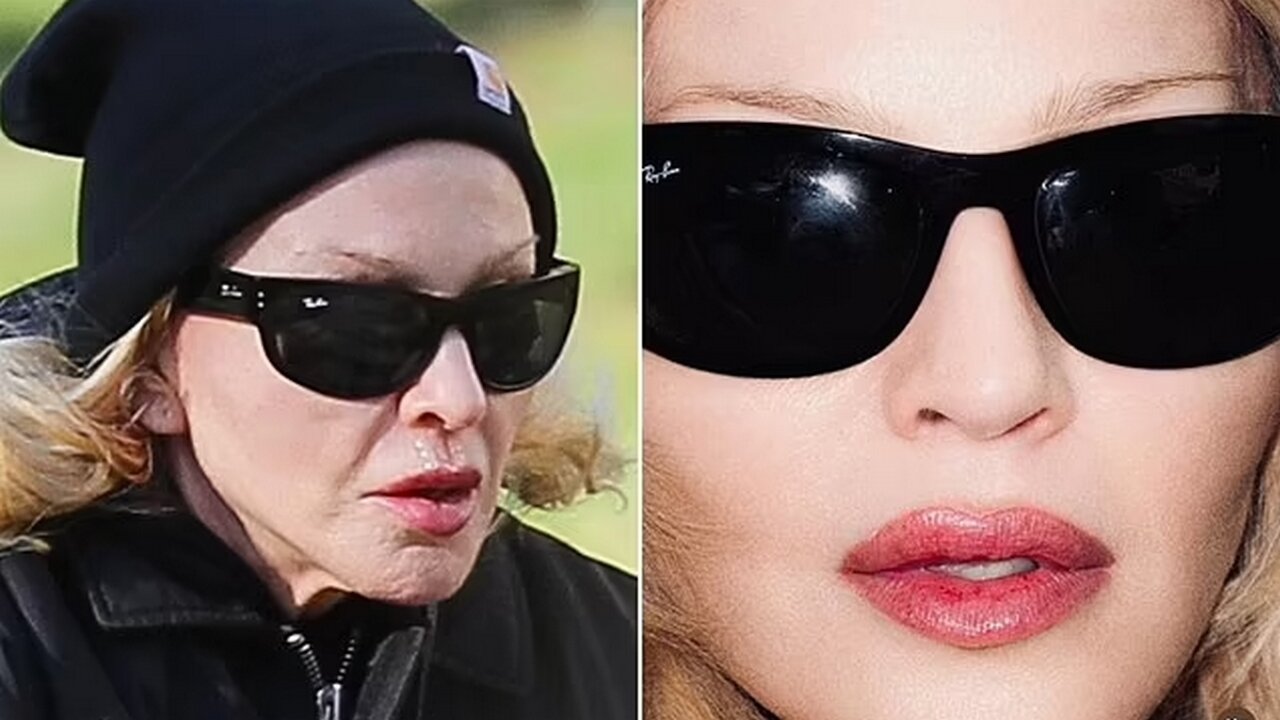 Madonna’s Real Face & Feud Ends