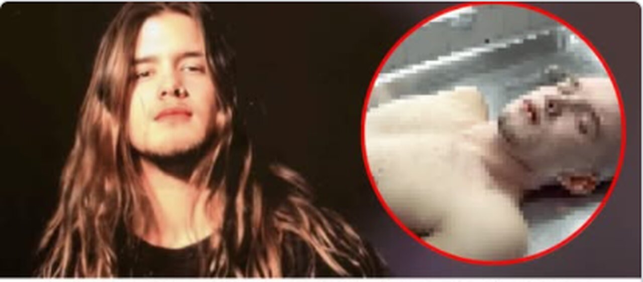 Disturbing Details Found In Shannon Hoon Autopsy Report - Good Old Days
