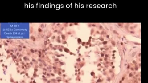 Spike Protein Totally Replacing Spermatazoa: Professor Arne Burkhardt