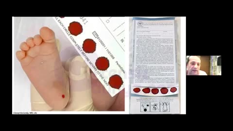 Topuk Kanı ve K Vitamini Gerçekten Gerekli Mi