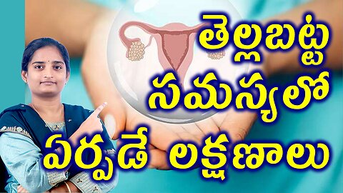 తెల్లబట్ట సమస్యలో ఏర్పడే లక్షణాలు Signs & Symptoms Of White Discharge Homeopathy Treatment Medicine