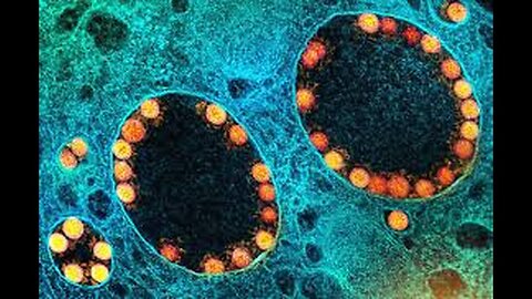 "Unraveling the Mystery: The Process of Isolating the SARS-CoV-2 Virus"